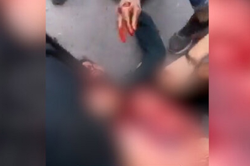 فیلم| بریدن گلوی مامور پلیس در اغتشاشات؛ روایت ماموری که آشوبگران در آمل گلویش را بریدند فیلم| بریدن گلوی مامور پلیس در اغتشاشات؛ روایت ماموری که آشوبگران در آمل گلویش را بریدند | دیلی 3