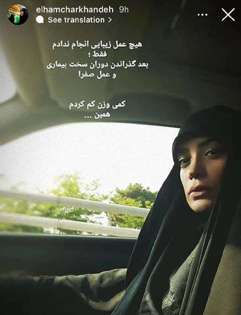 عکس| واکنش الهام چرخنده به عمل جراحی زیبایی | دیلی 3