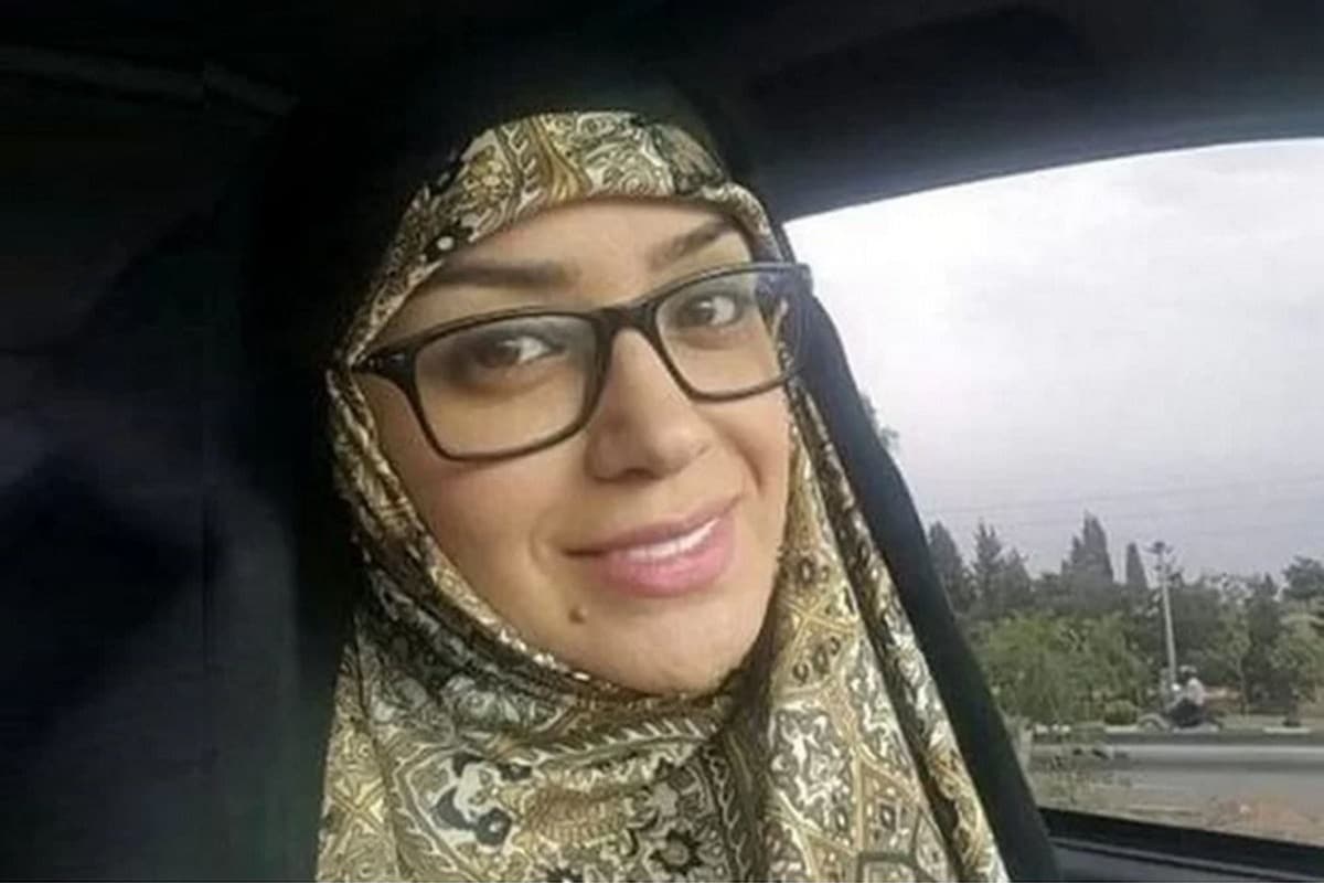 عکس| واکنش الهام چرخنده به عمل جراحی زیبایی | دیلی 3