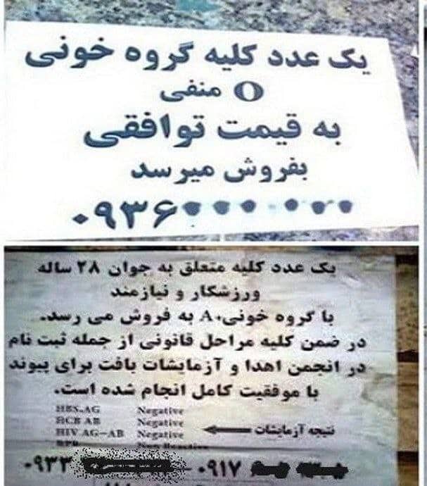عراقی ها خریدار «کلیه» ایرانیان به قیمت دلار! | دیلی 3