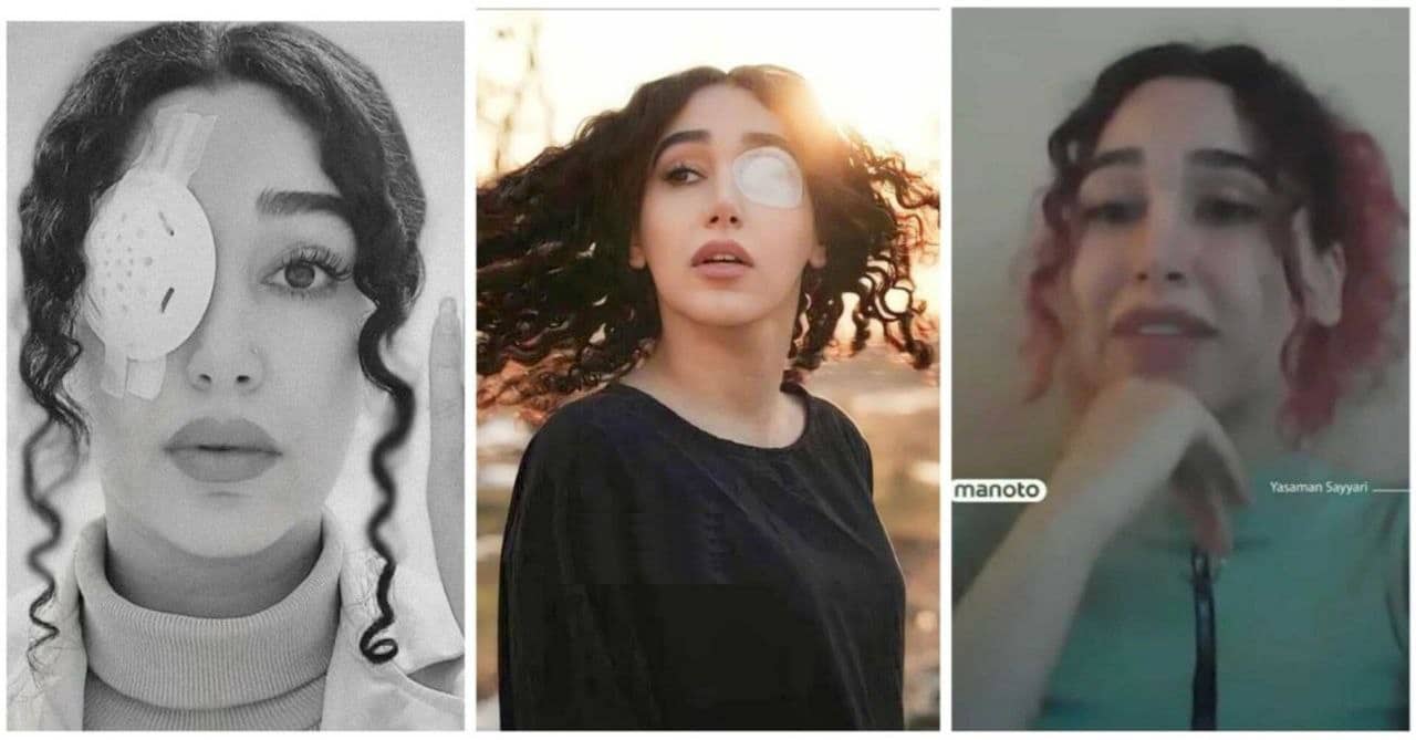 عکس| پس از رشد پاهای حسین رونقی؛ چشم نیلوفر آقایی جوانه زد عکس| پس از رشد پاهای حسین رونقی؛ چشم نیلوفر آقایی جوانه زد | دیلی 3