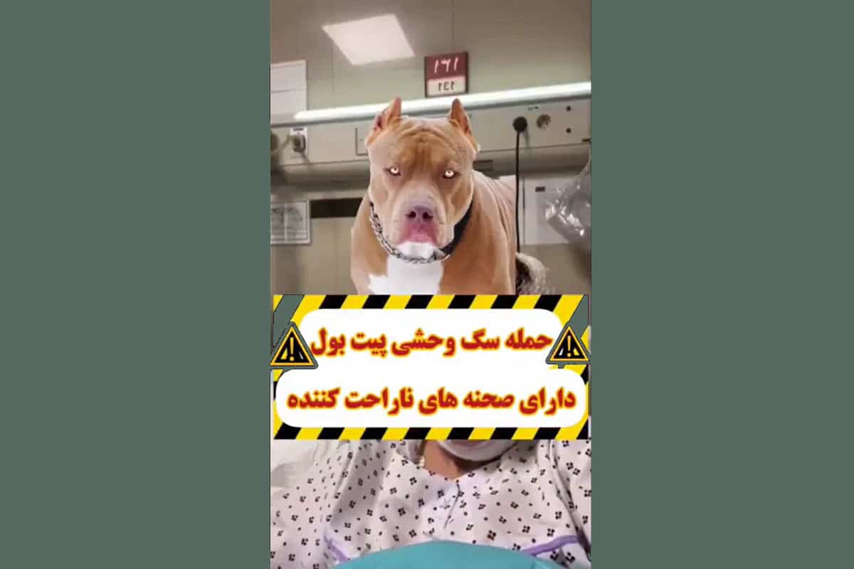 فیلم| حمله سگ پیت بول به یک خانم در شهرک غرب تهران | دیلی 3