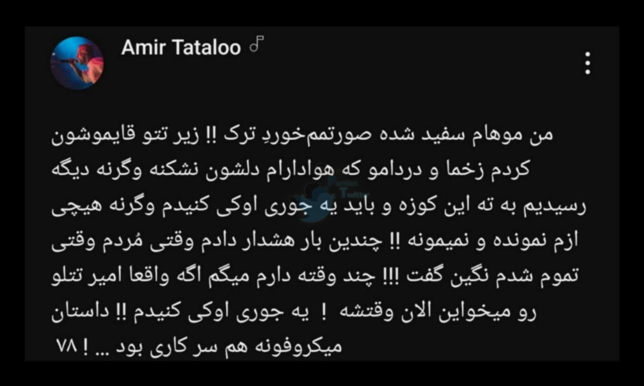 عکس| کلاهبرداری عجیب به نام خرید میکروفون برای امیر تتلو | دیلی 3