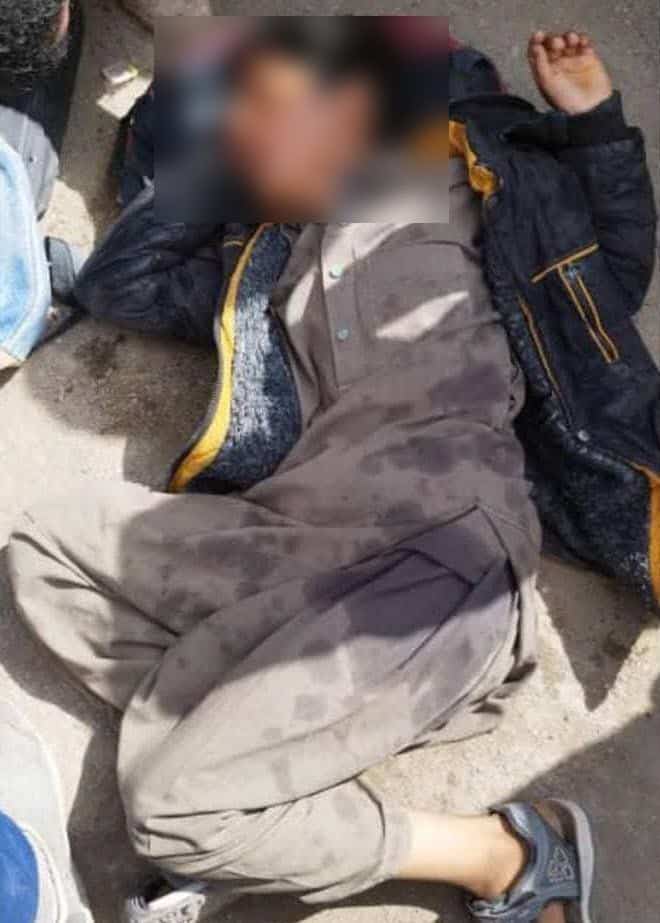 عکس| تنبیه هولناک دانش آموز زاهدانی توسط مدیر مدرسه؛ پسربچه بیهوش به بیمارستان منتقل شد | دیلی 3
