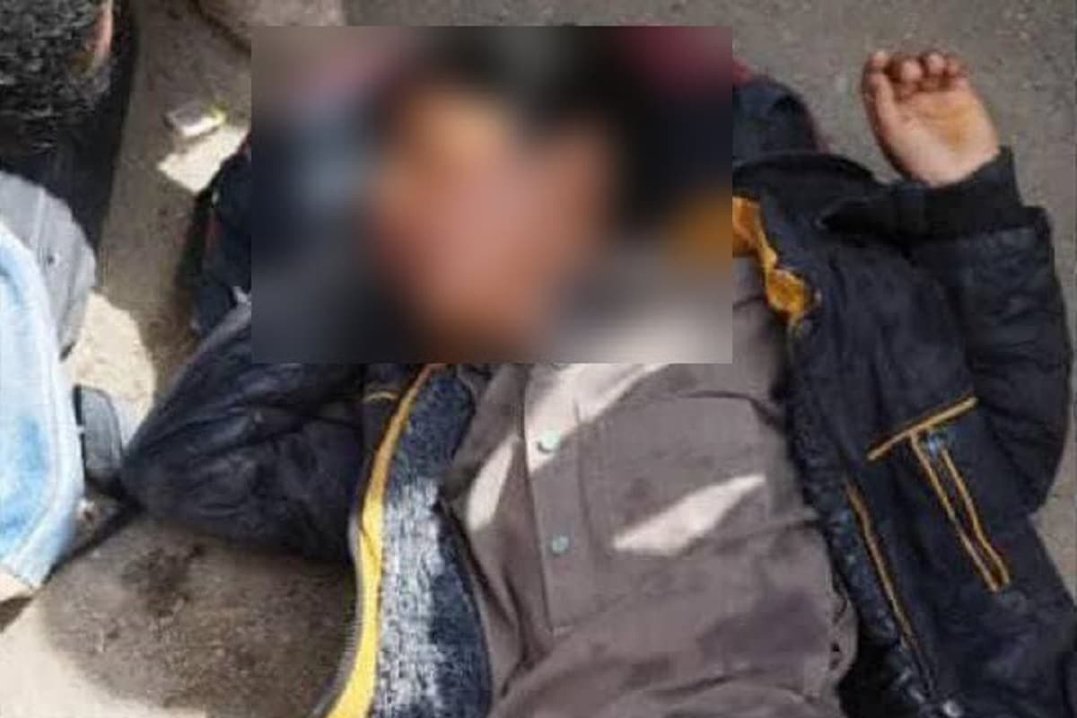 عکس| تنبیه هولناک دانش آموز زاهدانی توسط مدیر مدرسه؛ پسربچه بیهوش به بیمارستان منتقل شد | دیلی 3