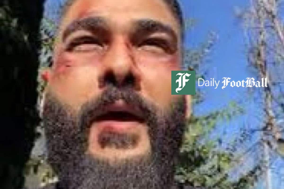 عکس| ضرب و شتم ساسی مانکن توسط نیروهای امنیتی ایران در عمان | دیلی 3