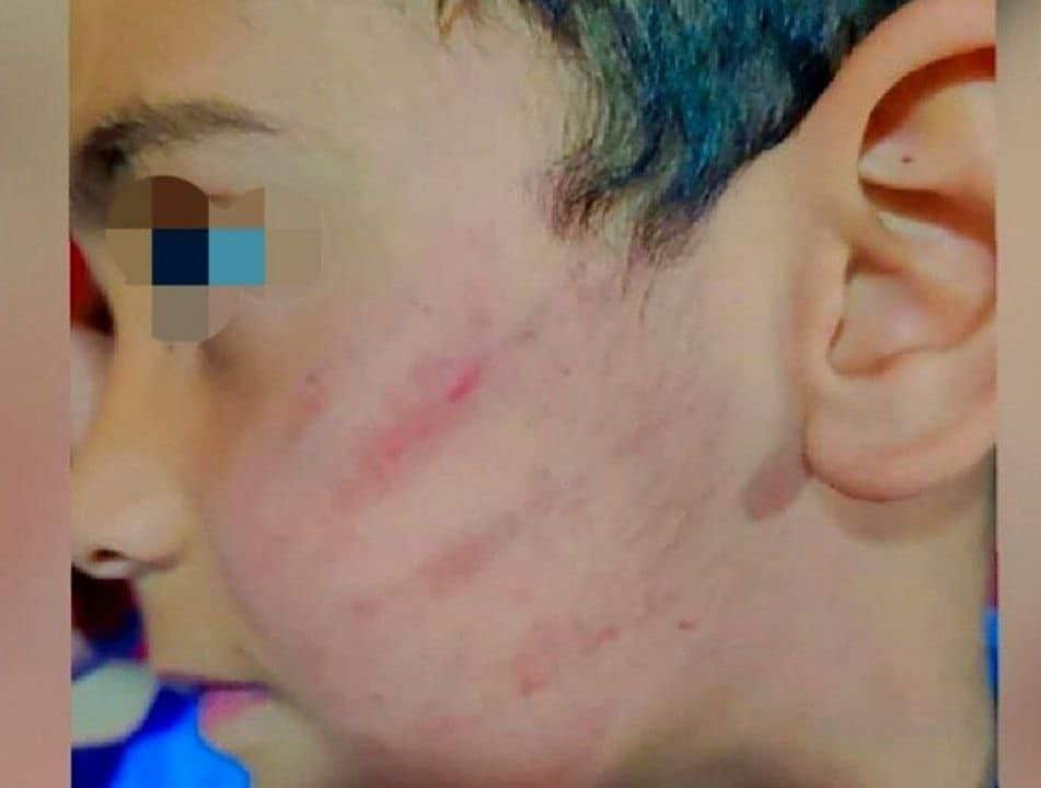 عکس| عاقبت کتک زدن دانش آموز کلاس اولی در سیستان و بلوچستان | دیلی 3