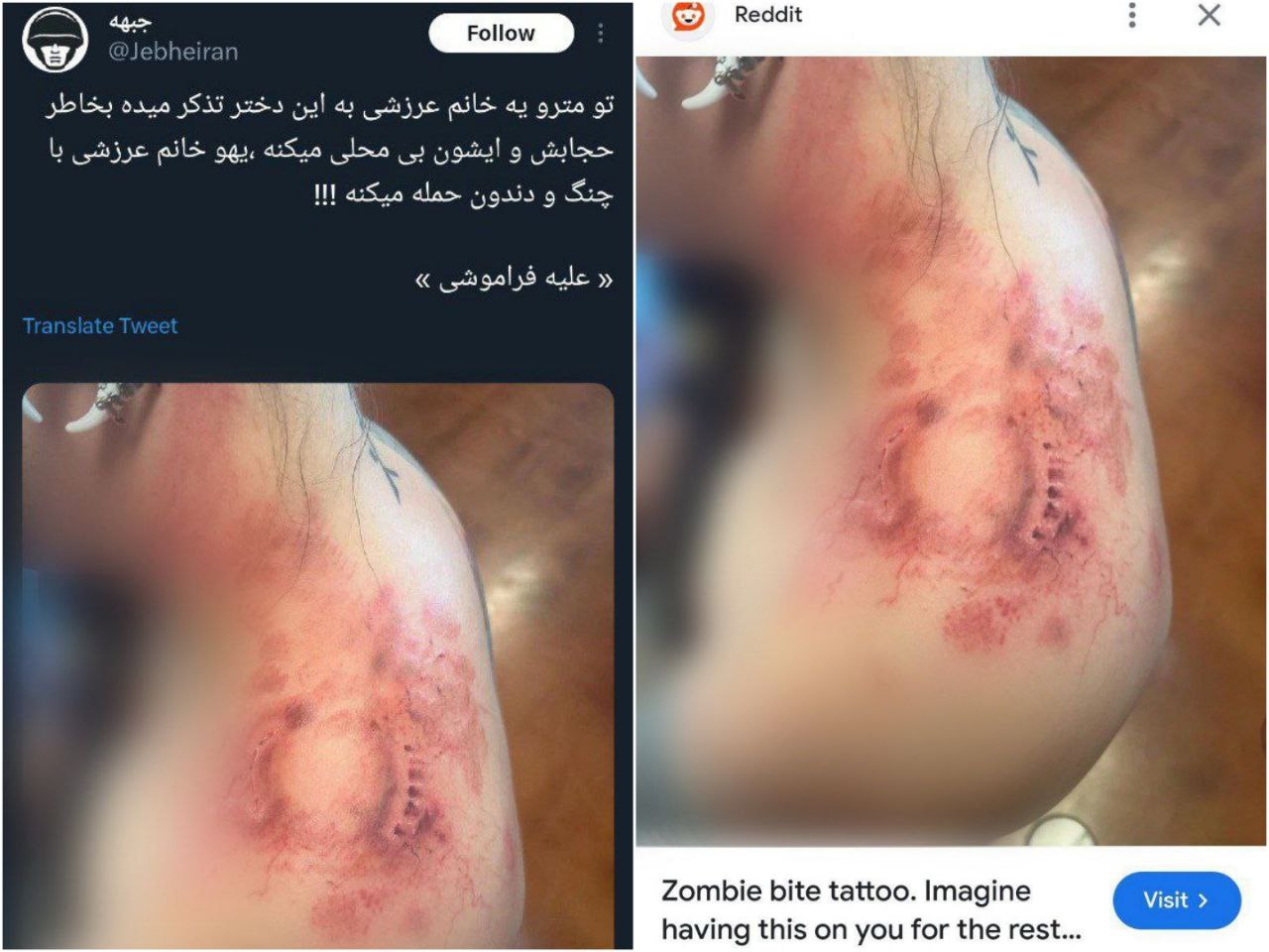 عکس| واقعیت ماجرای گاز گرفتن دختر بی حجاب توسط آمر به معروف در مترو عکس| واقعیت ماجرای گاز گرفتن دختر بی حجاب توسط آمر به معروف در مترو | دیلی 3
