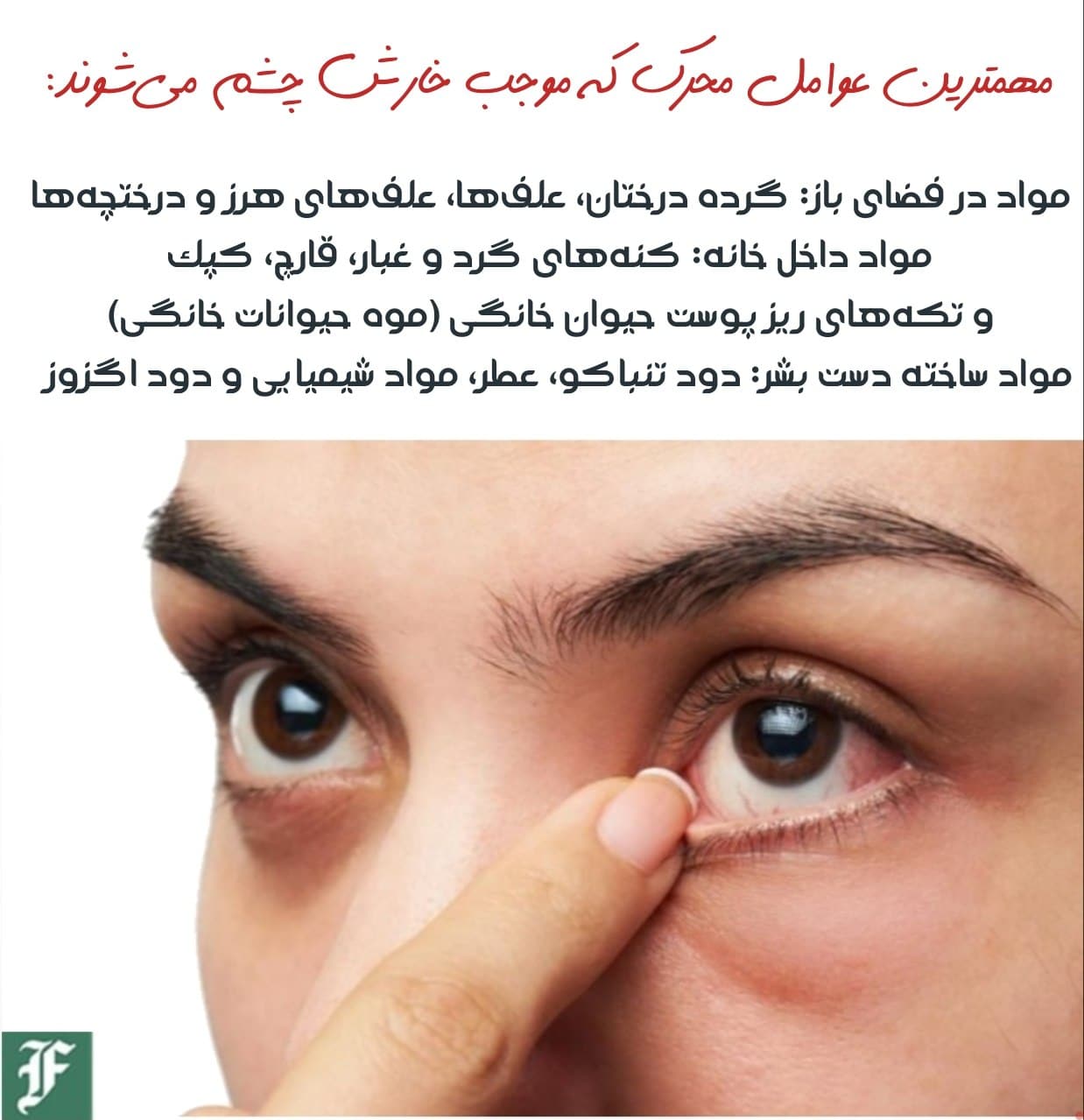 مهمترین علل خارش چشم و راه‌های درمان | دیلی 3