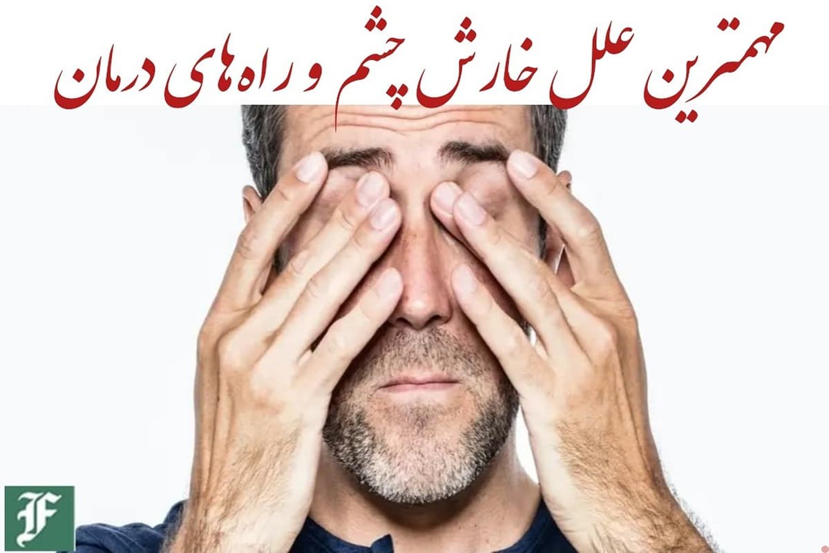 مهمترین علل خارش چشم و راه‌های درمان | دیلی 3
